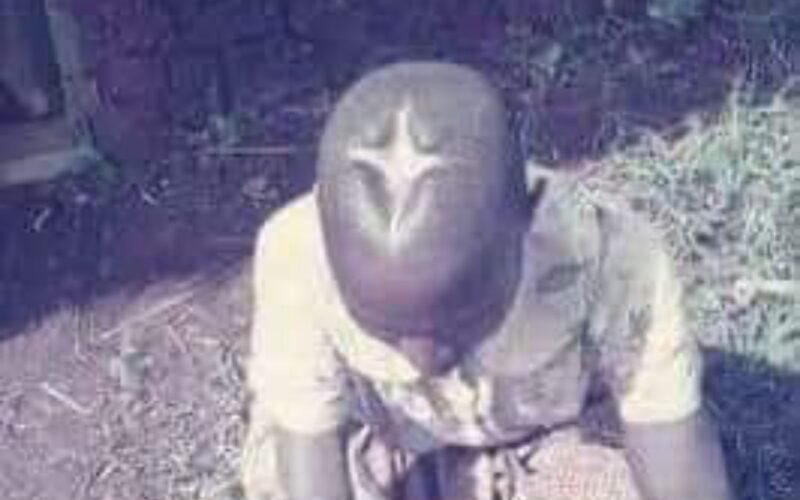 How Igbos Conducted Brain Surgery Centuries Ago.